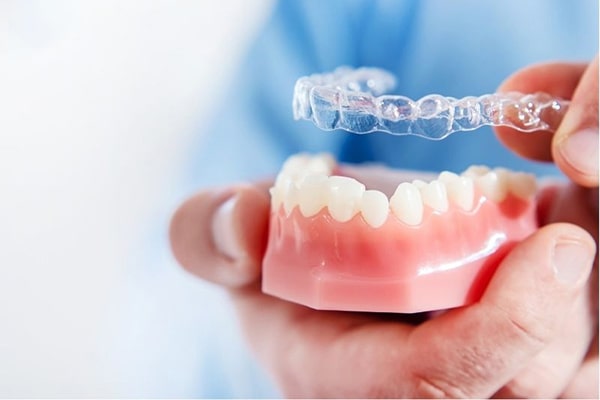 Cơ chế hoạt động của niềng răng trong suốt